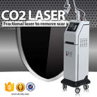 50-60Hz CO2 Fractional Laser Vigina Tightening Machine