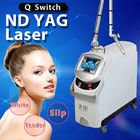 1064MM 755MM 532nm Q Switched Nd Yag Laser Machine
